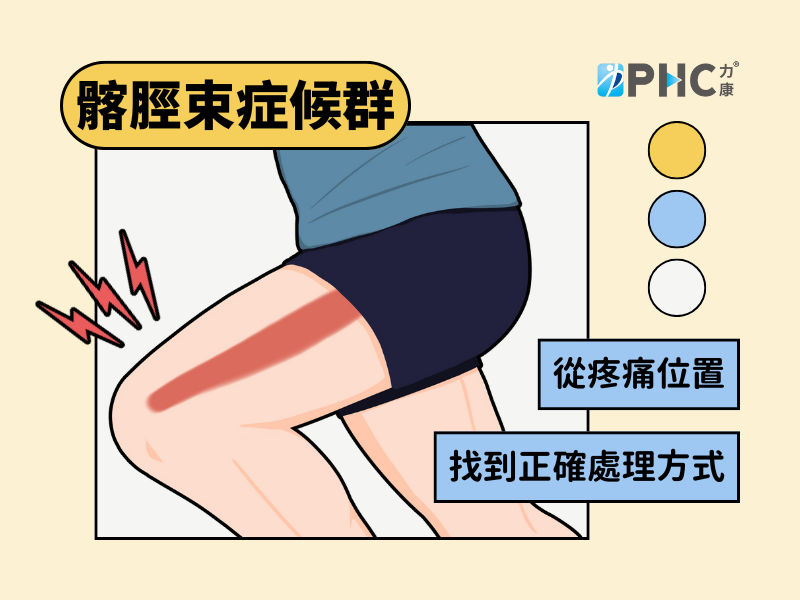惱人的膝部外側疼痛-髂脛束症候群